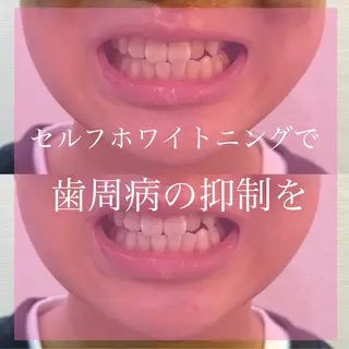 Livicate 💗🧁🎀🦋のマツエク・マツパデザイン