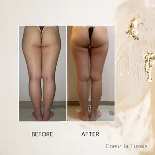 coeur la tusais ミライのエステ・リラクイメージ