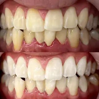 LBSホワイトニング 銀座店💎公式のその他イメージ