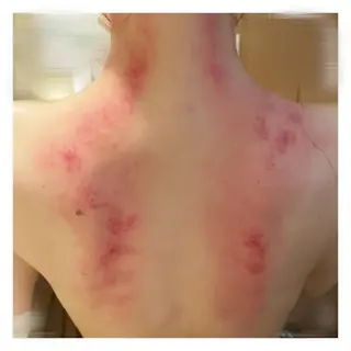 美腸専門 漢方よもぎ蒸しのエステ・リラクイメージ