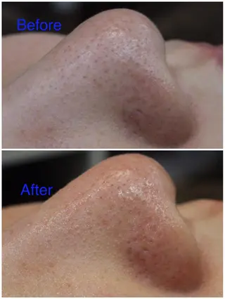 ANRIRE (アンリール)のエステ・リラクイメージ