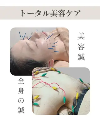 美容鍼/鍼灸 ここみ鍼灸院のエステ・リラクイメージ