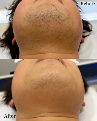 メンズ 瀬戸 梨子のエステ・リラクイメージ