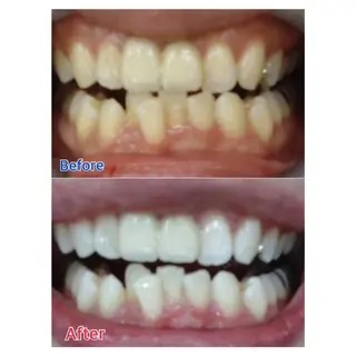 MBEAUTYSALON 千葉店・京成大久保所属・Melty 輝のその他イメージ