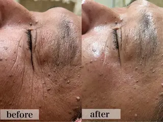 フェイシャル/脱毛 ジョアアンジェ竹田のエステ・リラクイメージ