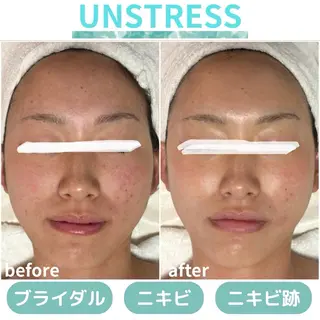 肌質改善|天王寺 For...はるかのエステ・リラクイメージ