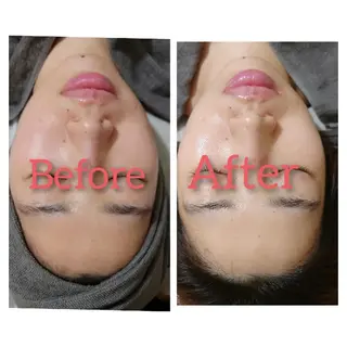 Beauty Salon Luana所属・Luanaまつパ脱毛 ハーブピーリング眉毛のマツエク・マツパデザイン