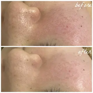 メンズ メナード岐阜市茜部 杉浦のエステ・リラクイメージ