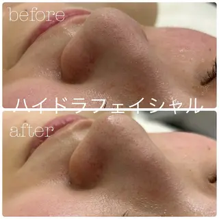 フェイシャルサロン CHIARA 荒田のエステ・リラクイメージ