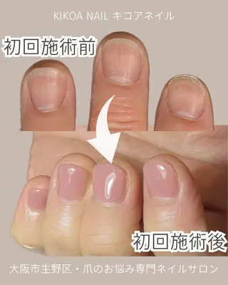 ネイル KIKOA NAIL キコアネイルのネイルデザイン