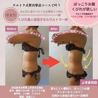 痩身ハーブピーリング 筋膜リリース☆B&Hのエステ・リラクイメージ