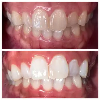 セルフホワイトニング専門店WHITE金沢店所属・伊藤 勢のエステ・リラクイメージ