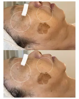 田中For..天王寺 肌質改善/よもぎ蒸しのエステ・リラクイメージ