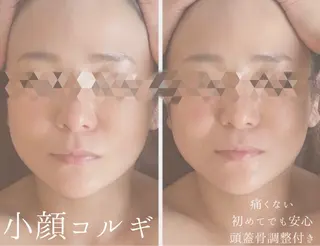 ハイフ・小顔・骨盤 シャングリラのエステ・リラクイメージ