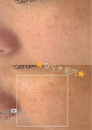 韓国🇰🇷価格 サロン_Nbibiのエステ・リラクイメージ