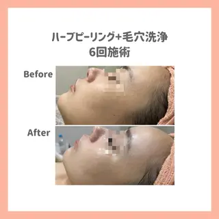 ハーブピーリング専門 muro.のエステ・リラクイメージ