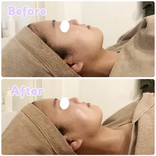 MiMiy 銀座店のエステ・リラクイメージ