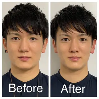 メンズ 医療提携Ruby所属・医療提携Ruby小顔 ハーブピーリングのその他イメージ