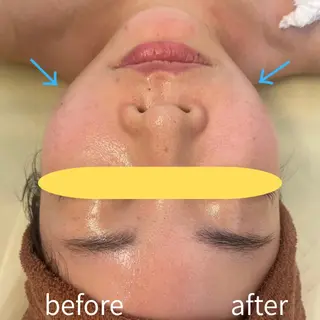 aliaハイフ&水光ジェットサロン所属・aliaハーブ水光店 エステティシャン募集のエステ・リラクイメージ