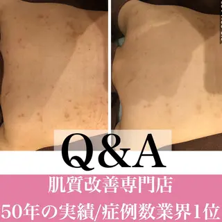 ミディアム カラー パーマ ヘアアレンジ メンズ キッズ ネイル マツエク・マツパ ニキビ・肌質改善専門 ♡人生が変わるサロンのエステ・リラクイメージ