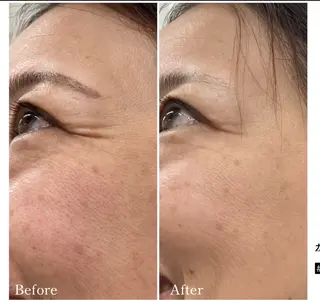 Total Beauty salon Bloom所属・肌育WISHpro 専門サロンBloomのエステ・リラクイメージ