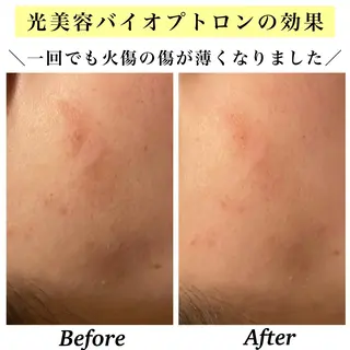 Bellesthe （ベルエステ）のエステ・リラクイメージ