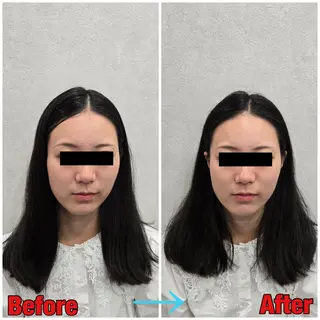 小顔矯正・美容鍼 FLOW鍼灸整体院のエステ・リラクイメージ