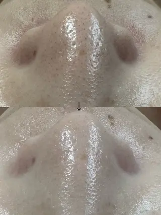 beautysalon LIMOA所属・松本 愛絵理のエステ・リラクイメージ