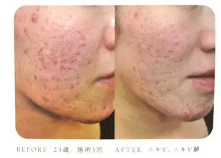 むくみ専門痩身 マクイエステティックのエステ・リラクイメージ