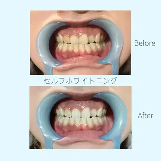 メンズ 男女同額完全個室脱毛 LEPIA内田のエステ・リラクイメージ