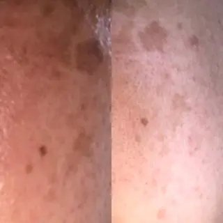 首・肩こり専門リンパ ケアサロンSENKAのエステ・リラクイメージ