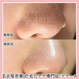  毛穴洗浄・まつ毛 の専門店 ソラーレのエステ・リラクイメージ