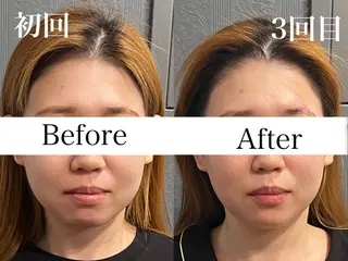 骨気&Relaxation Vivian 名駅所属・遠藤 芹華のエステ・リラクイメージ