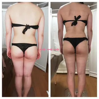 biloop所属・《痩身×疲労改善》 BILOOPのエステ・リラクイメージ