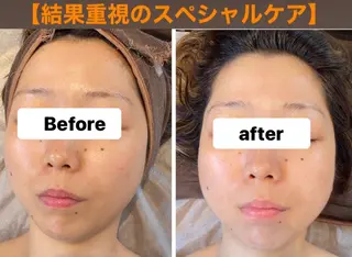 脱毛・エステサロン LuLuNのエステ・リラクイメージ