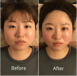 本格小顔コルギサロン ミピマムマールのエステ・リラクイメージ