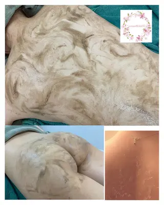 【剥離ありハーブピーリング専門エステ】cerisier BEAUTÉ 原宿所属・cerisier BEAUTÉのエステ・リラクイメージ