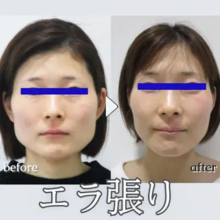 銀座美.design 藤沢店のエステ・リラクイメージ