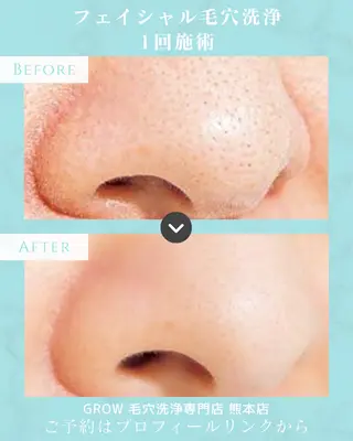 韓国式フェイシャル エステGROW熊本店のエステ・リラクイメージ