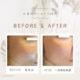 シミケア専門店 Saimervellのエステ・リラクイメージ