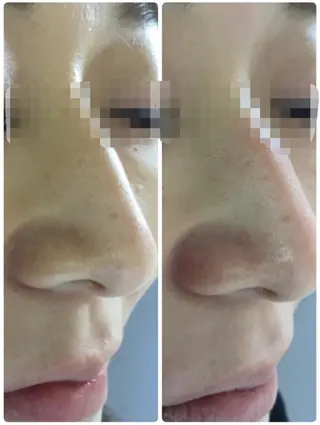 肌質改善サロンChouChou所属・肌質改善サロン chouchouのエステ・リラクイメージ