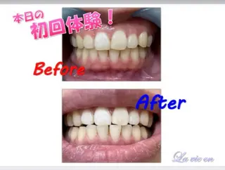 セルフホワイトニングサロン　ラヴィアン所属・ホワイトニングサロン La vie enのその他イメージ