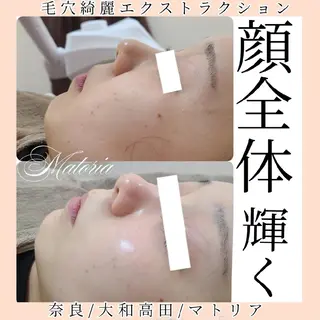 小顔と美肌 まごころエステMatoria所属・小顔 美肌専門 Matoriaのエステ・リラクイメージ