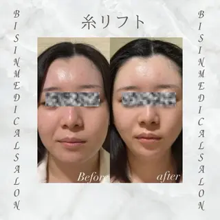 新宿南口 まどのエステ・リラクイメージ