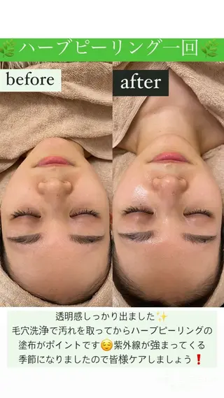 Salon de Lino 御器所のエステ・リラクイメージ