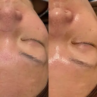 はり灸サロン totonoi所属・印象の良くなる 美容鍼のエステ・リラクイメージ