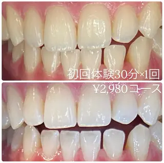 PLATINUM Beauty 横浜店所属・ホワイトニングルーム 横浜店のその他イメージ