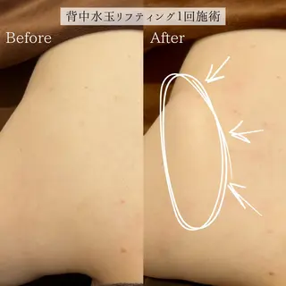 小顔美肌：ミアンカ 京阪モール本館1Fのエステ・リラクイメージ