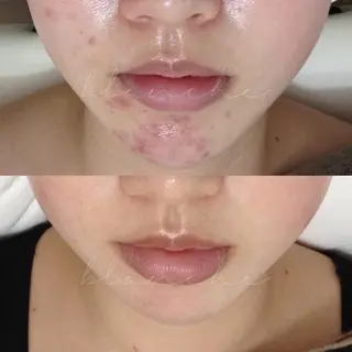 セミロング カラー パーマ ヘアアレンジ ネイル マツエク・マツパ アイブロウ 都度払い肌質改善 &脱毛Blancheのエステ・リラクイメージ