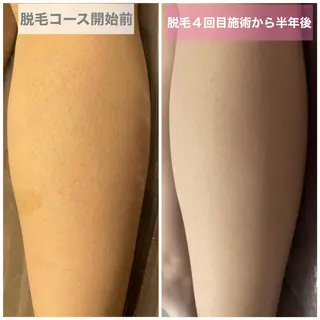 中尾 朱里のエステ・リラクイメージ